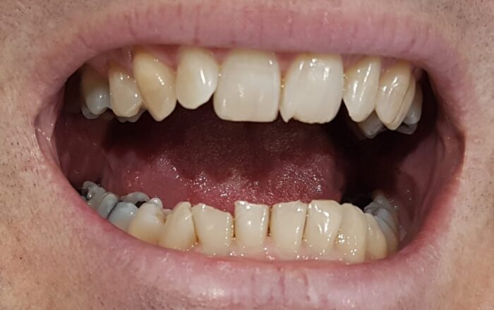 Before - Denpure Dental