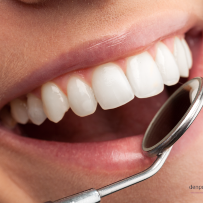 Close up of female set of straight white teeth