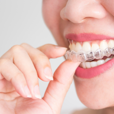 blog - Denpure Dental